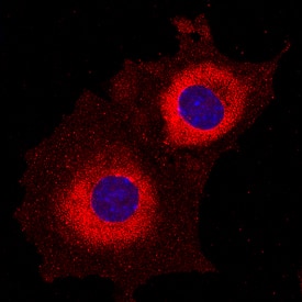 Ribosomal Protein S6/RPS6 antibody in MM55K Mouse Cell Line by Immunocytochemistry (ICC).