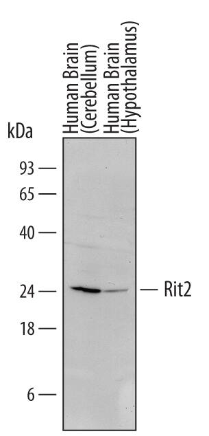 Detection of Human Rit2 antibody by Western Blot.