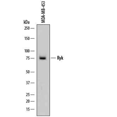 Detection of Human Ryk antibody by Western Blot.