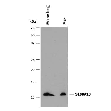 Detection of Mouse S100A10 antibody by Western Blot.