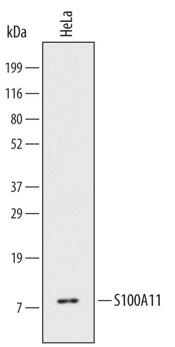 Detection of Human S100A11 antibody by Western Blot.