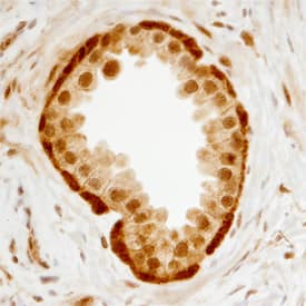 S100A2 antibody in Human Prostate by Immunohistochemistry (IHC-P).