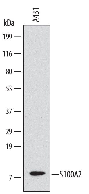 Detection of Human S100A2 antibody by Western Blot.