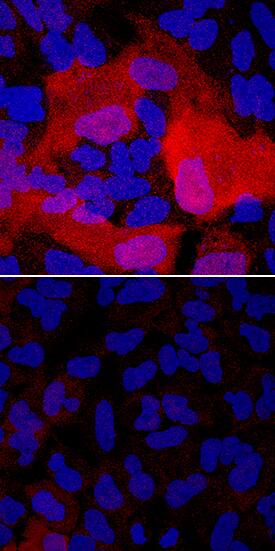 S100A4 in A549 Human Cell Line. S100A4 antibody in A549 Human Cell Line by Immunocytochemistry (ICC).