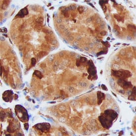 S100A6 antibody in Human Kidney by Immunohistochemistry (IHC-P).