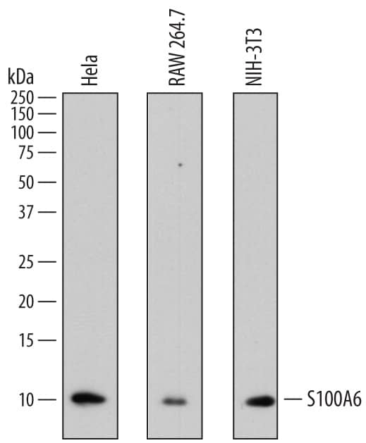 Detection of Human and Mouse S100A6 antibody by Western Blot.