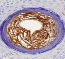 S100A7 antibody in Human Skin by Immunohistochemistry (IHC-P).