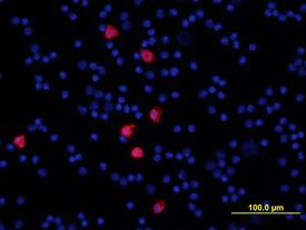 S100A8 antibody in Mouse Splenocytes by Immunocytochemistry (ICC).