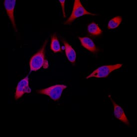 S100A8 antibody in HeLa Human Cell Line by Immunocytochemistry (ICC).