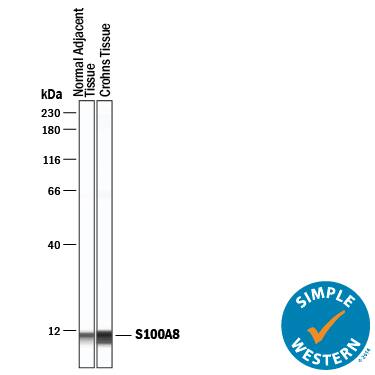 Detection of Human S100A8 antibody by Simple WesternTM.