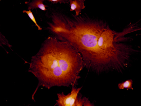 S100A9 antibody in XB2 Mouse Cell Line by Immunocytochemistry (ICC).