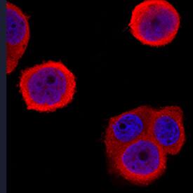 S100A9 antibody in MDA-MB-468 Human Cell Line by Immunocytochemistry (ICC).
