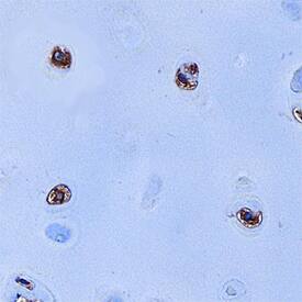 S100A9 antibody in Human Cartilage by Immunohistochemistry (IHC-P).