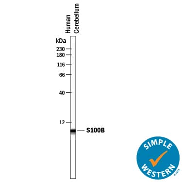 Detection of Human S100B antibody by Simple WesternTM.