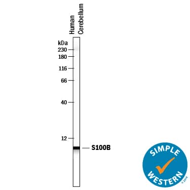 Detection of Human S100B antibody by Simple WesternTM.
