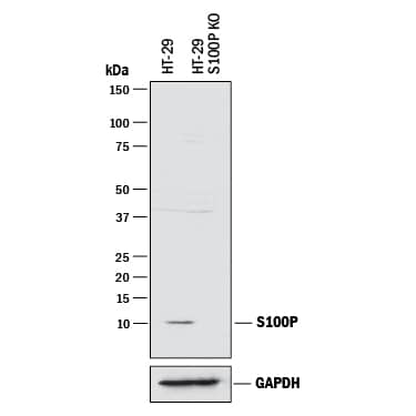 Detection of Human S100P antibody by Western Blot.