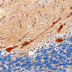 SACS antibody in Human Brain by Immunohistochemistry (IHC-P).