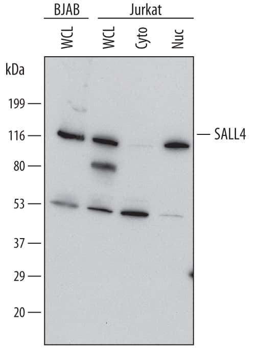 Detection of Human SALL4 antibody by Western Blot.