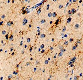 SALM3/LRFN4 antibody in Human Brain by Immunohistochemistry (IHC-P).