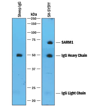 Immunoprecipitation of Human SARM1.