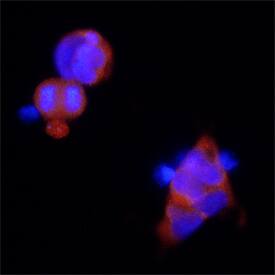 SARM1 antibody in HEK293 Human Cell Line by Immunocytochemistry (ICC).