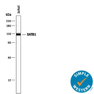 Detection of Human SATB1 antibody by Simple WesternTM.