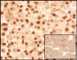 Sleeping Beauty Transposase antibody in Mouse Liver by Immunohistochemistry (IHC-P).