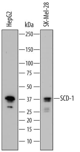 Detection of Human SCD-1 antibody by Western Blot.