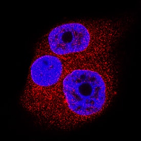 SUMO-Specific Peptidase 1/SENP1 antibody in T47D Human Cell Line by Immunocytochemistry (ICC).