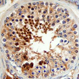 SUMO1-Specific Peptidase 1/SENP1 antibody in Human Testis by Immunohistochemistry (IHC-P).