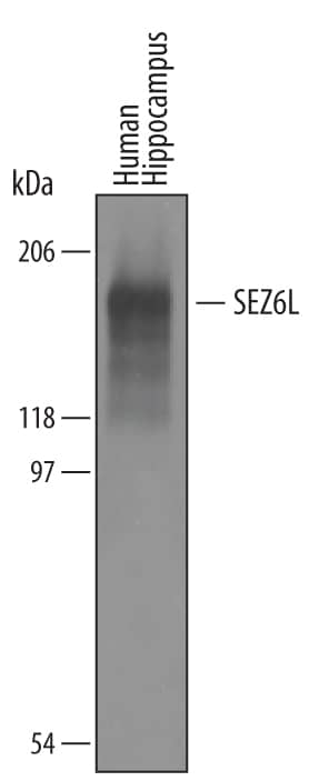 Detection of Human SEZ6L antibody by Western Blot.