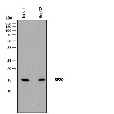 Detection of Human SF20/MYDGF antibody by Western Blot.