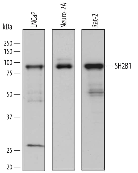 Detection of Human, Mouse, and Rat SH2B1 antibody by Western Blot.