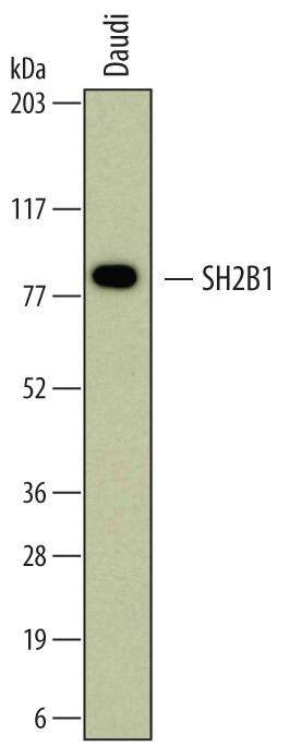 Detection of Human SH2B1 antibody by Western Blot.