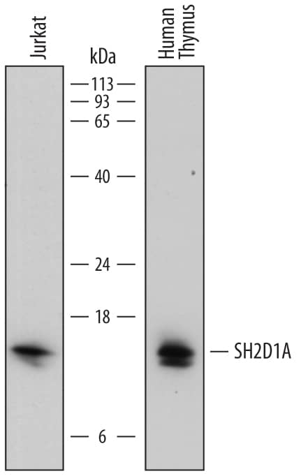 Detection of Human SH2D1A antibody by Western Blot.