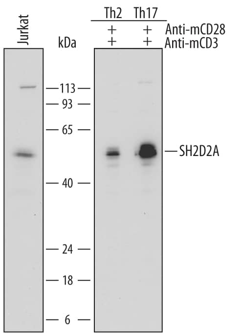 Detection of Human SH2D2A antibody by Western Blot.