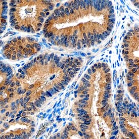 SHARPIN antibody in Human Ovary by Immunohistochemistry (IHC-P).
