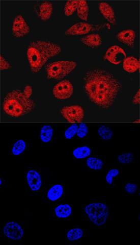 SHIP2 antibody in PC-3 Human Cell Line by Immunocytochemistry (ICC).