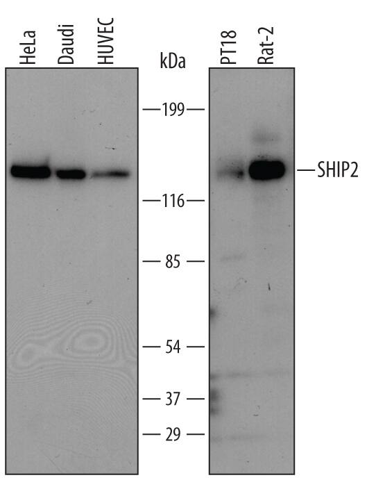 Detection of Human/Mouse/Rat SHIP2 antibody by Western Blot.