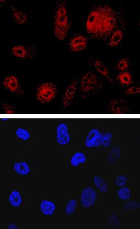 SHIP2 antibody in PC-3 Human Cell Line by Immunocytochemistry (ICC).