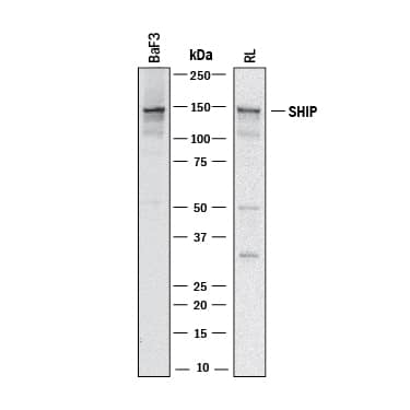 Detection of Human and Mouse SHIP antibody by Western Blot.