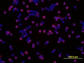 SHIP antibody in Mouse Splenocytes by Immunocytochemistry (ICC).