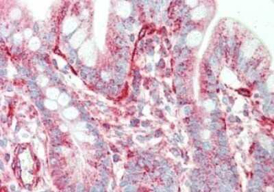 Immunohistochemistry: SIPA1 Antibody [NBP1-77947]