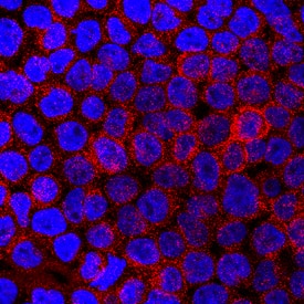 SIRPa/CD172a antibody in THP-1 Human Cell Line by Immunocytochemistry (ICC).