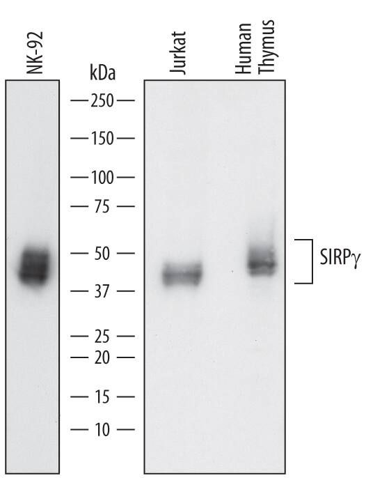 Detection of Human SIRP?/CD172g antibody by Western Blot.