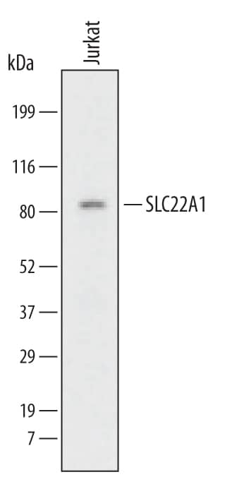 Detection of Human SLC22A1 antibody by Western Blot.