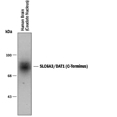 Detection of SLC6A3/DAT1 (C-Terminus) antibody by Western Blot.