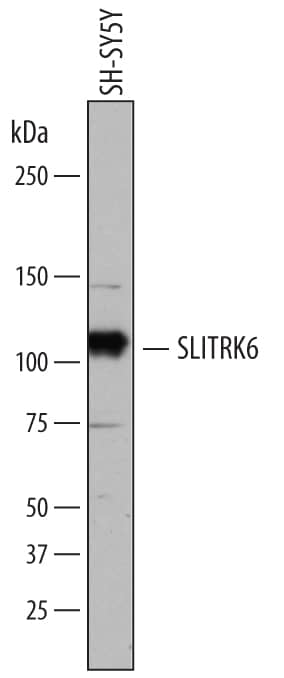 Detection of Human SLITRK6 antibody by Western Blot.