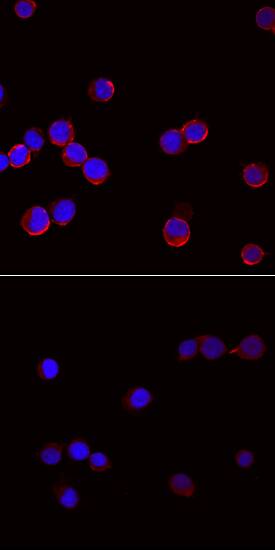 Phospho-SLP-76/LCP2 (Y145) antibody in Jurkat Human Cell Line by Immunocytochemistry (ICC).