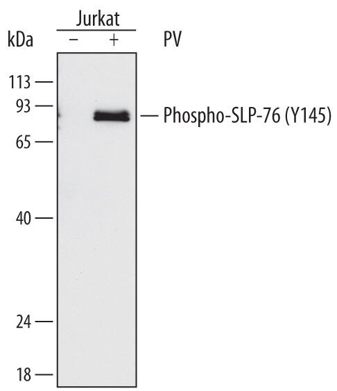 Detection of Human Phospho-SLP-76/LCP2 antibody by Western Blot.